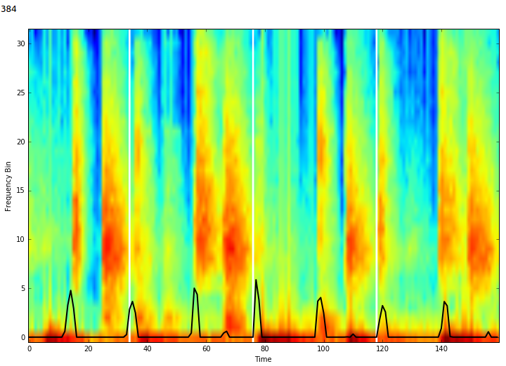 Pulse Prediction in Validation Set Over Spectogram